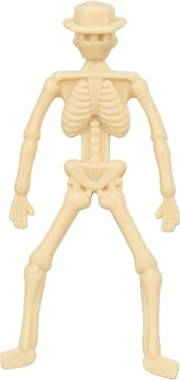 overig
